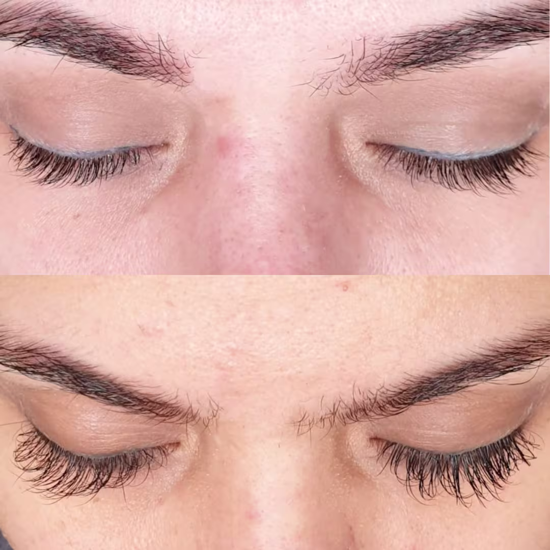 Eyebrow growth serum results showing fuller and darker brows after treatment